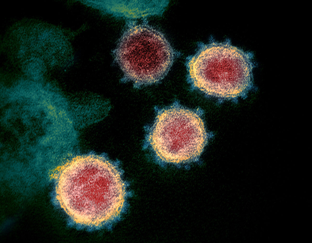 Idcm Infectious Diseases And Clinical Microbiology